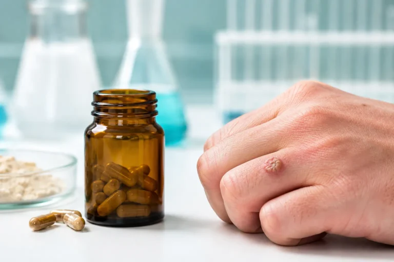 Can AHCC Help Clear Hand Warts?