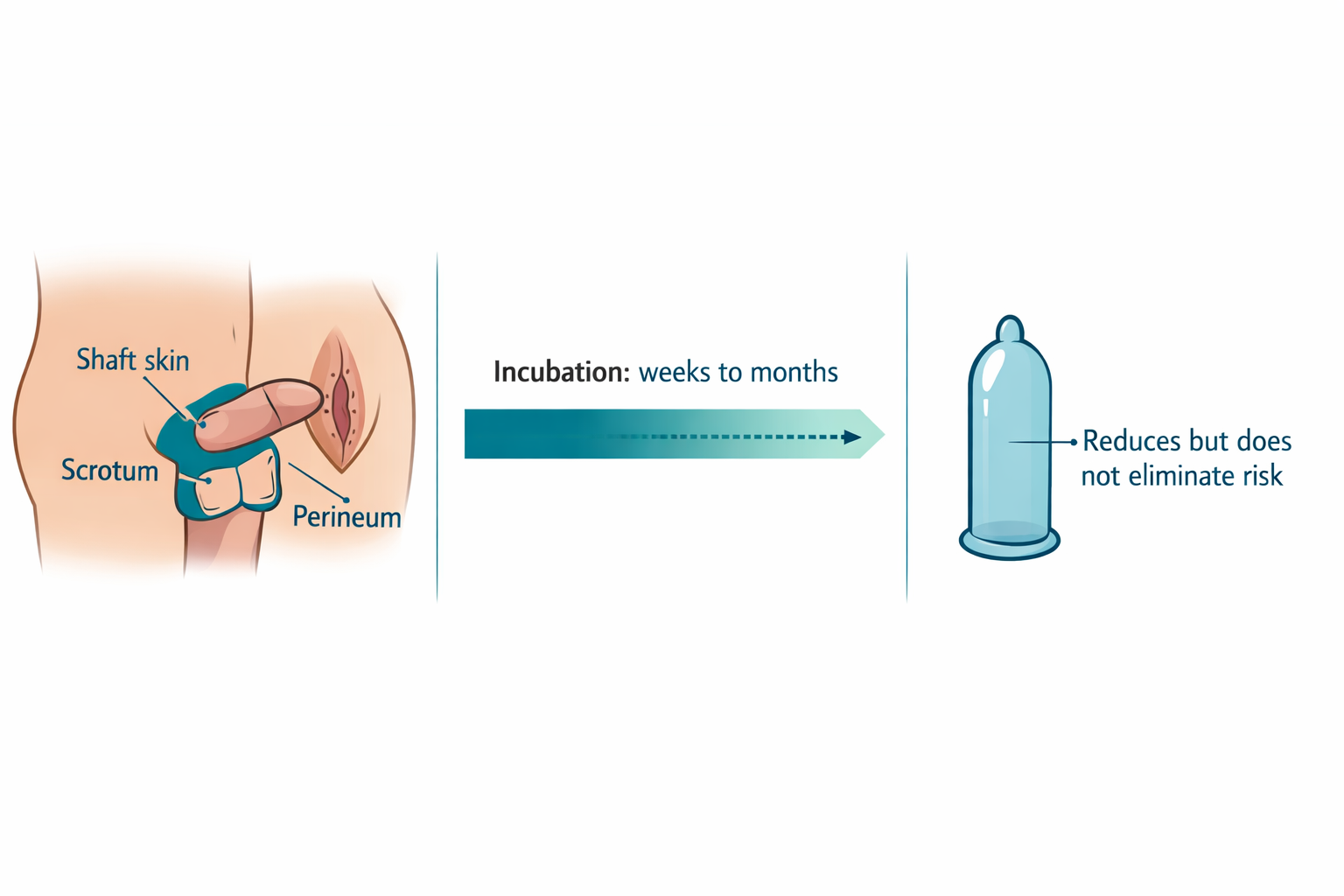 How Does a Man Transmit HPV to a Woman?