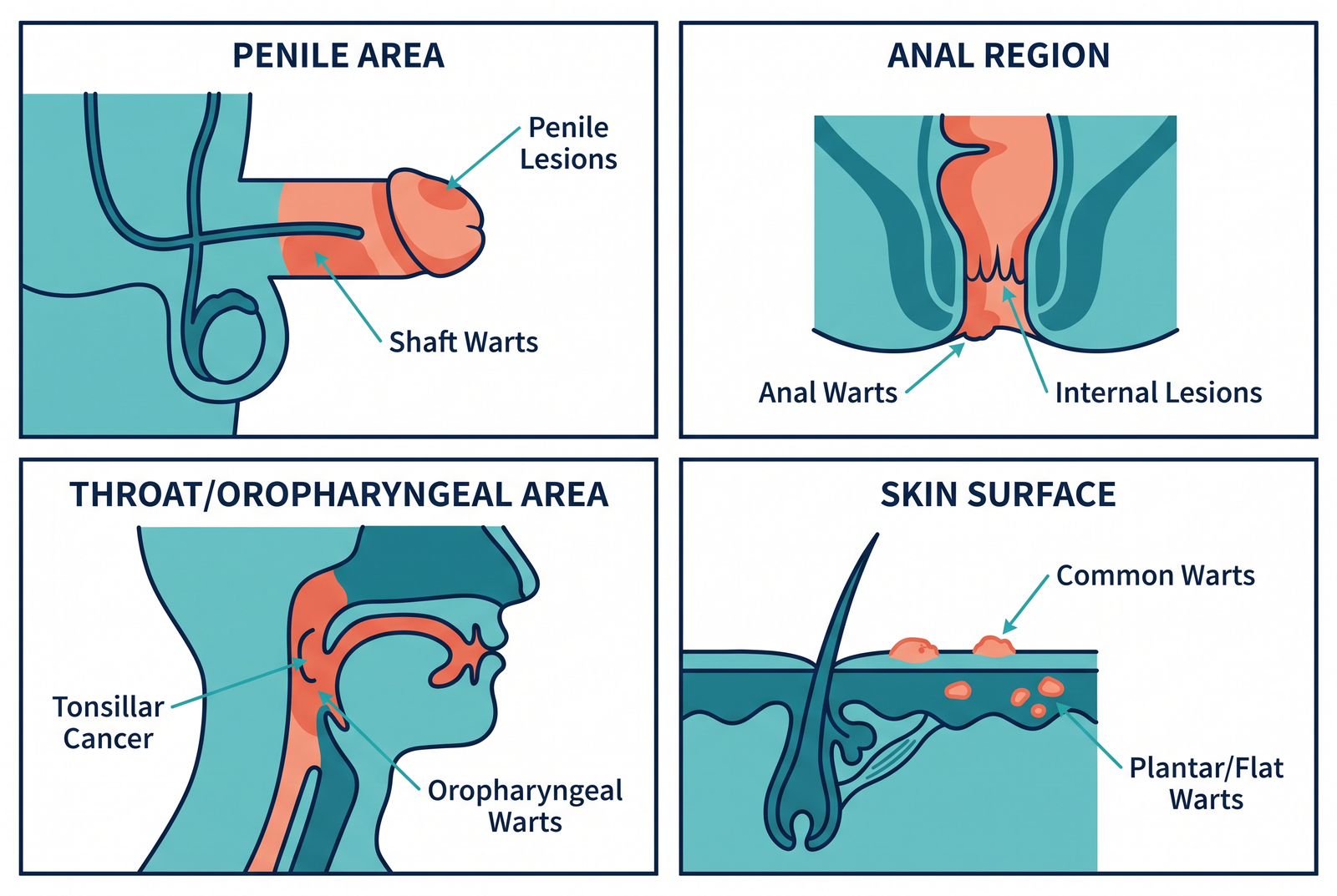 How Does HPV Affect Men?