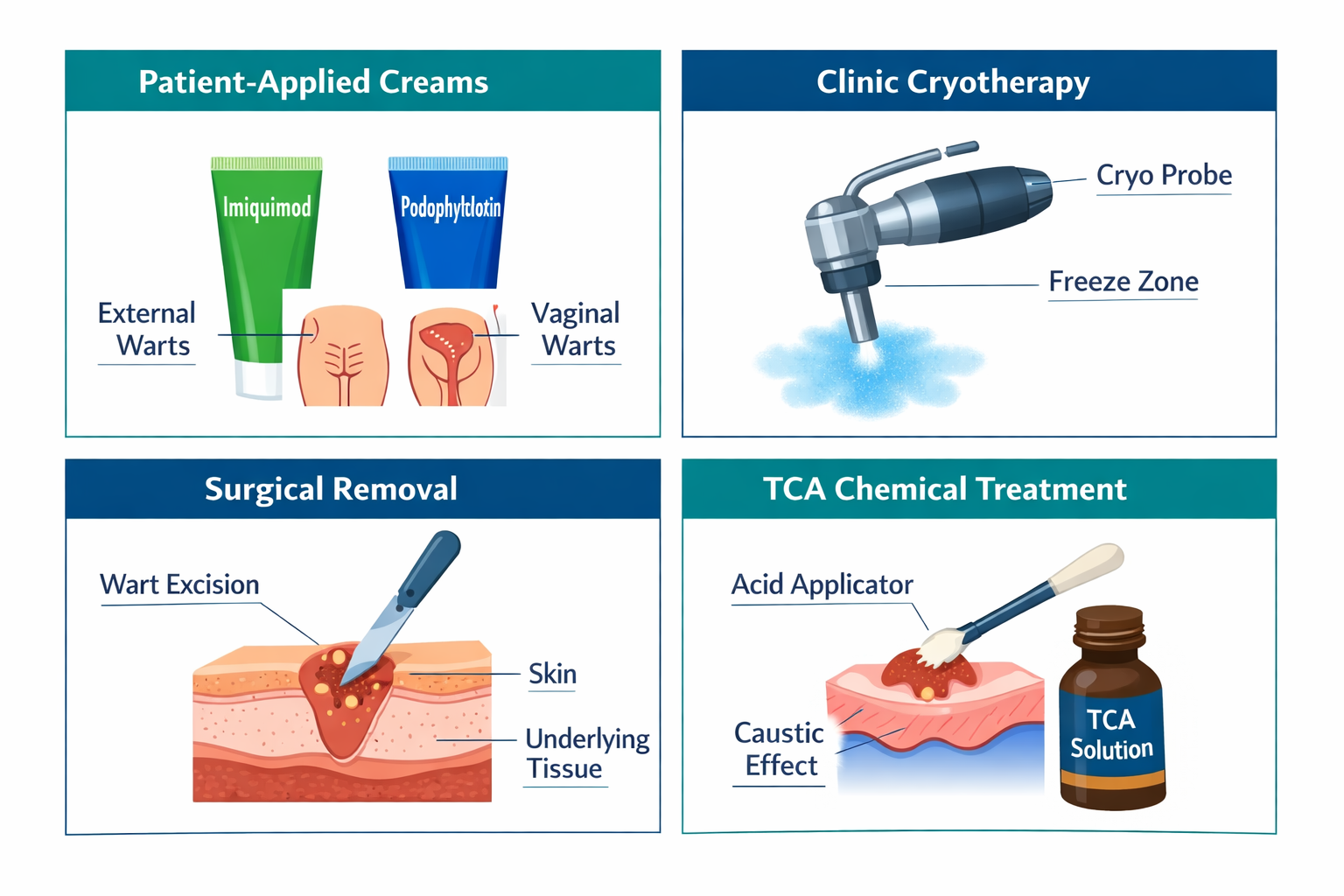 What Causes Genital Warts and Why "Cure" Is Complicated