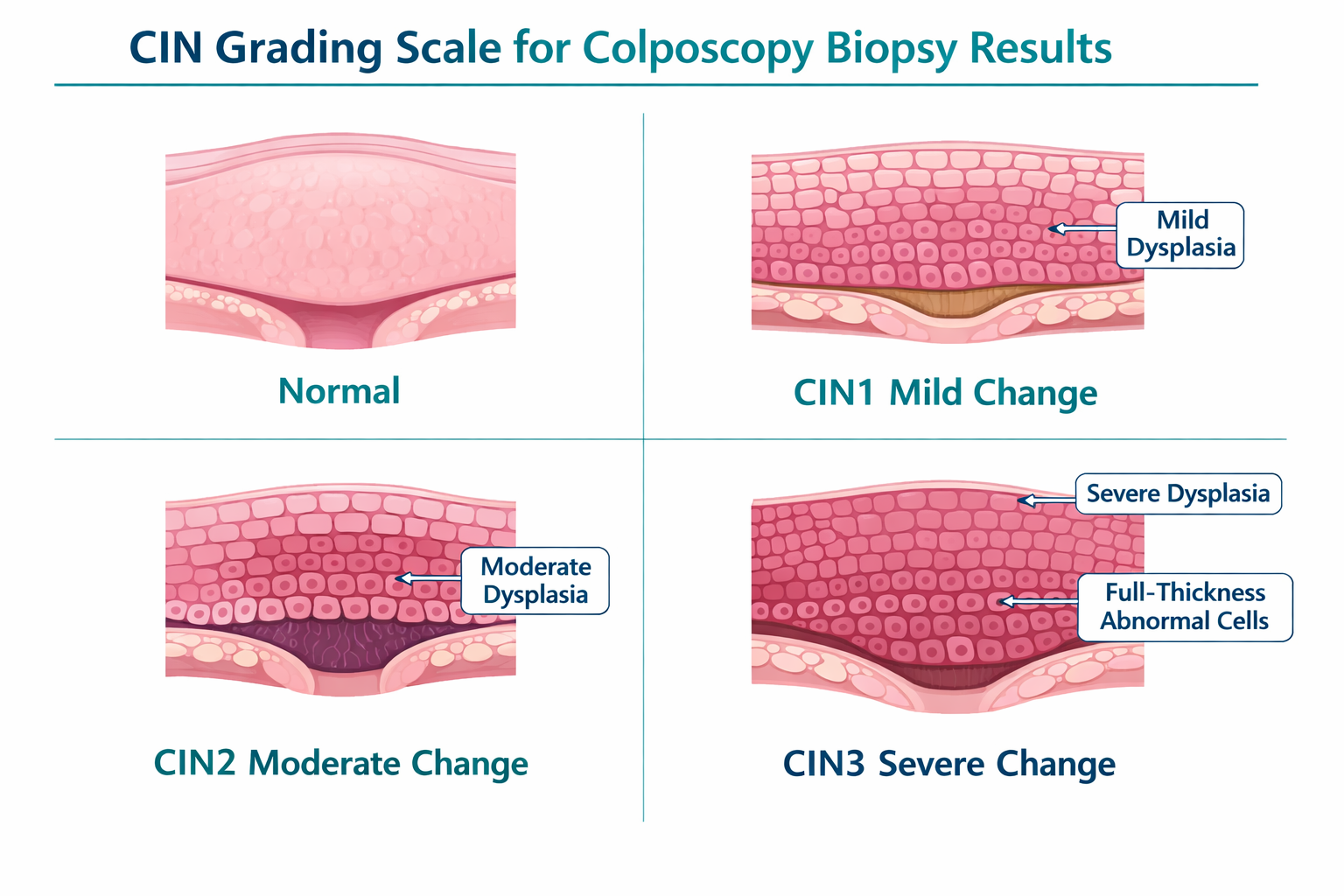 Why You're Having a Colposcopy in the First Place