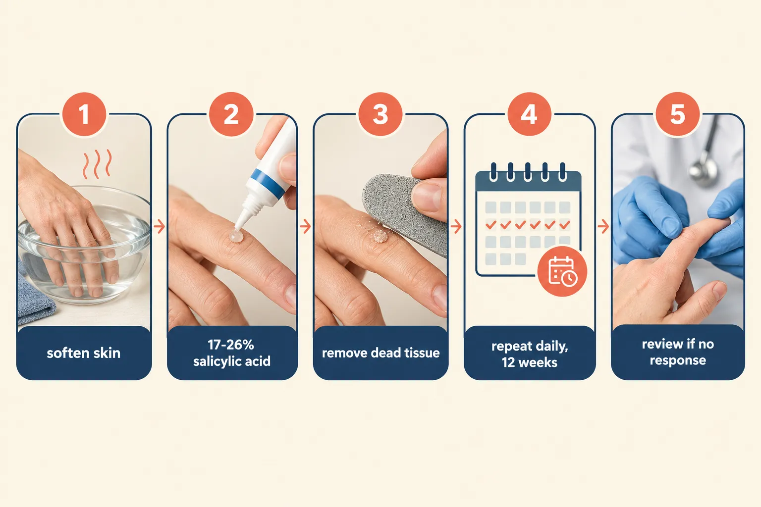 How Early-Stage Hand Warts Are Treated
